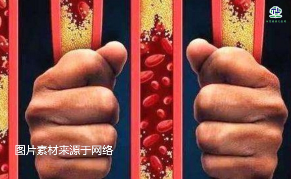 不想給血管&ldquo;添堵&rdquo;，盡量少吃以下這些東西，或許能讓腦梗離遠(yuǎn)些  